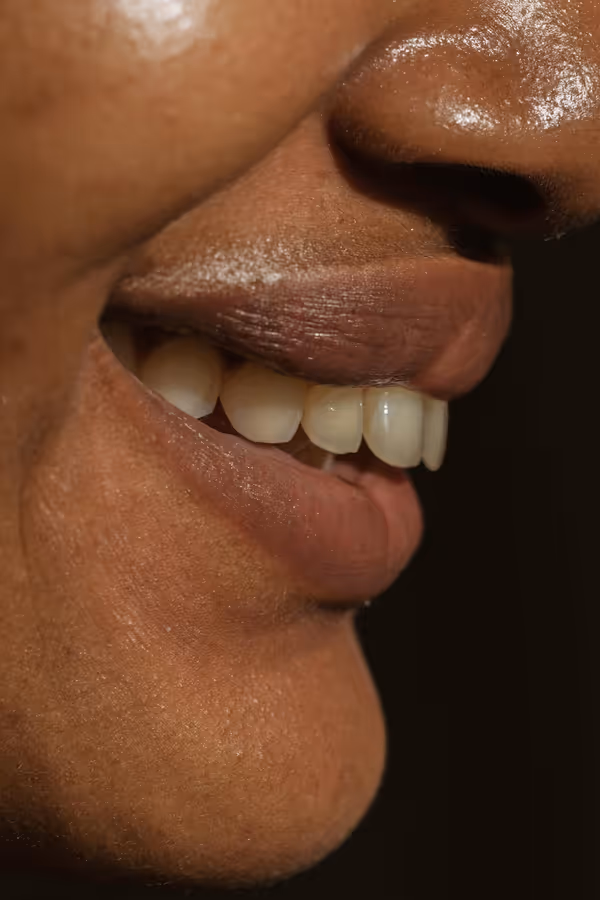 Homem sorrindo e exibindo dentes perfeitos