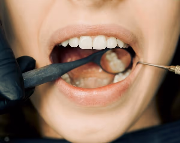 Dentista avaliando os dentes da paciente